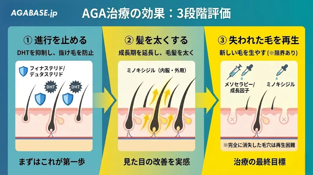 AGA治療の効果三段階評価図